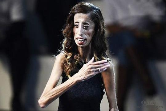 盘点全球15个最奇葩女人 颠覆你的世界观